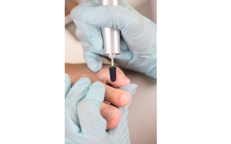 Колпачок шлиф. d=16 мм, крупная крошка,(синие) 10шт/уп. фото 2