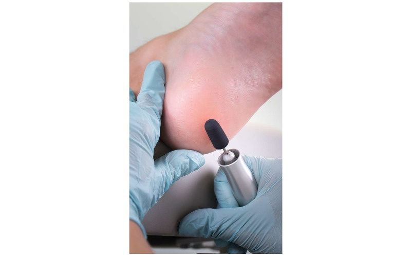 Колпачок шлиф. d=16 мм, крупная крошка,(синие) 10шт/уп. фото 3